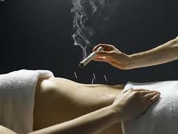moxibustion